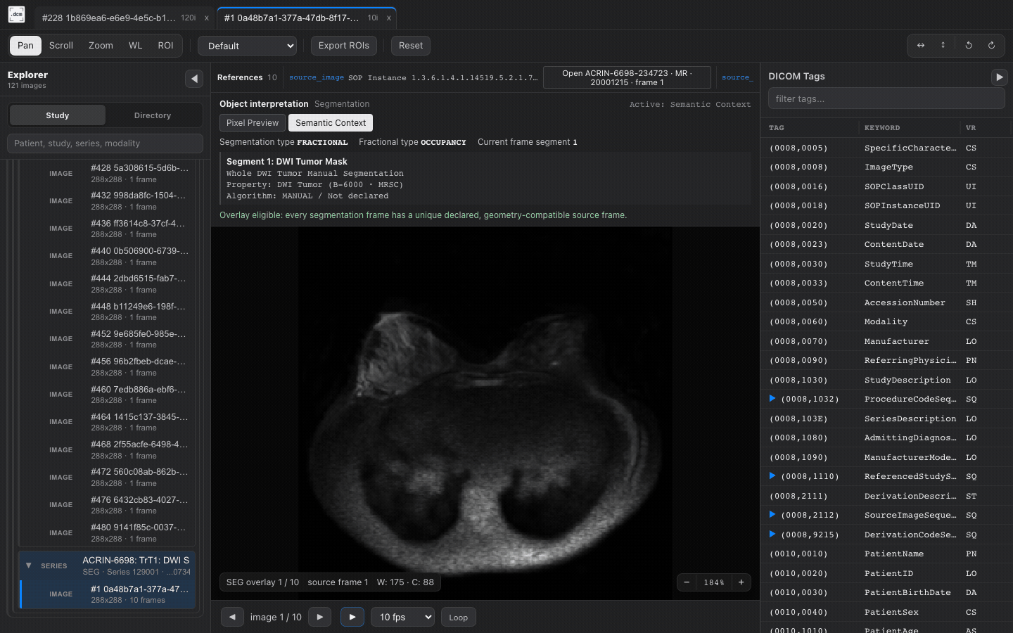 DICOM SEG semantic overlay in dcmview