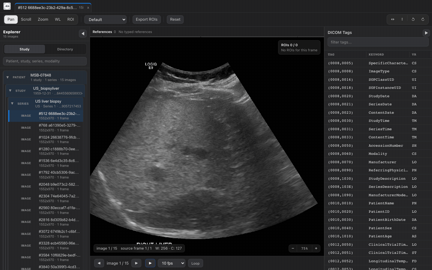 Ultrasound cine playback in dcmview